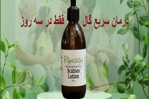 درمان فوری گال
