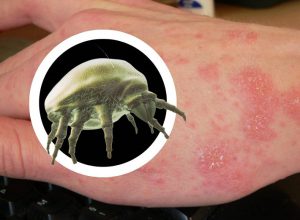 نشانه‌ های خوب شدن گال