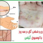 نحوه نمونه‌گیری گال
