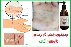 نحوه نمونه‌گیری گال