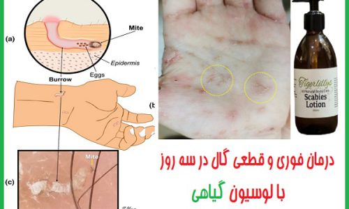 نحوه نمونه‌گیری گال