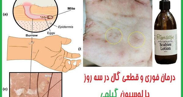 نحوه نمونه‌گیری گال