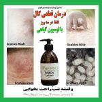درمان سریع گال در خانه