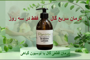 طول درمان گال