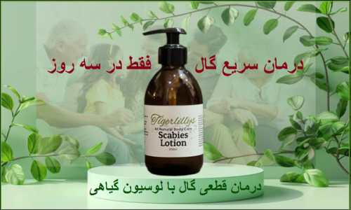 طول درمان گال