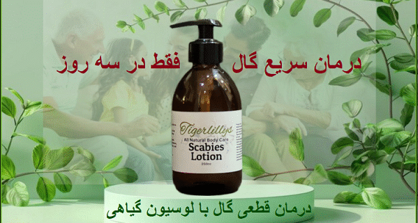 طول درمان گال