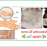 درمان گال با زردچوبه