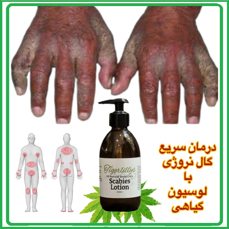 تصویر گال نروژِی