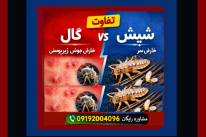 تفاوت گال با شپش