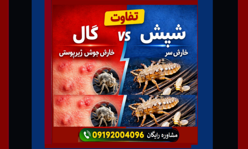 تفاوت گال با شپش