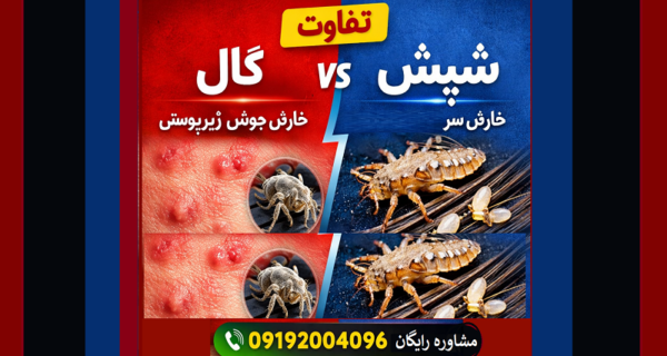 تفاوت گال با شپش