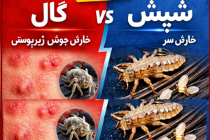 تفاوت گال با شپش