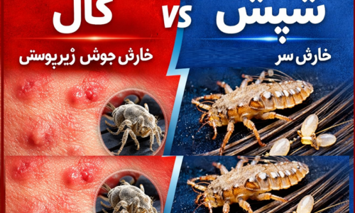 تفاوت گال با شپش