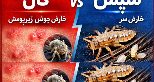 تفاوت گال با شپش