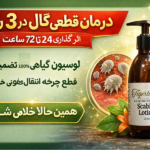درمان قطعی گال در ۳ روز