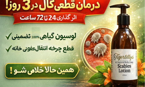 درمان قطعی گال در ۳ روز