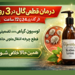درمان قطعی گال در ۳ روز