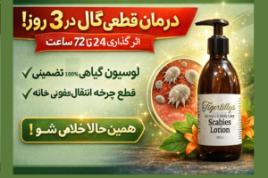 درمان قطعی گال در ۳ روز