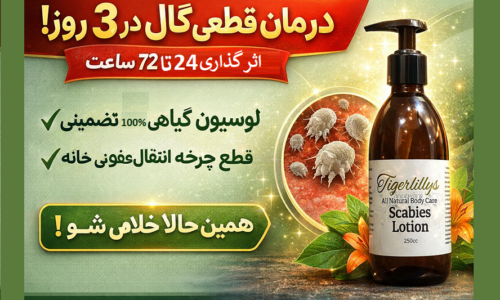 درمان قطعی گال در ۳ روز