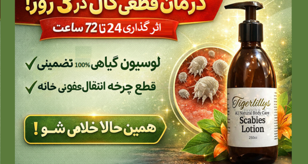 درمان قطعی گال در ۳ روز