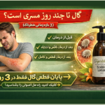 گال تا چند روز مسری است؟