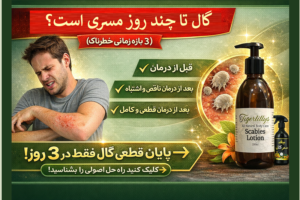 گال تا چند روز مسری است؟