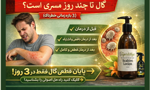 گال تا چند روز مسری است؟